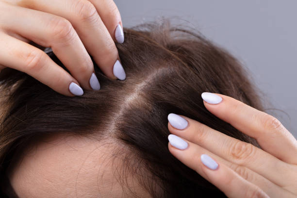 4 stages of the Hair Growth: The Anagen, Catagen, Telogen, & Exogen