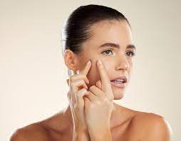 Skin Breakout Treatment
