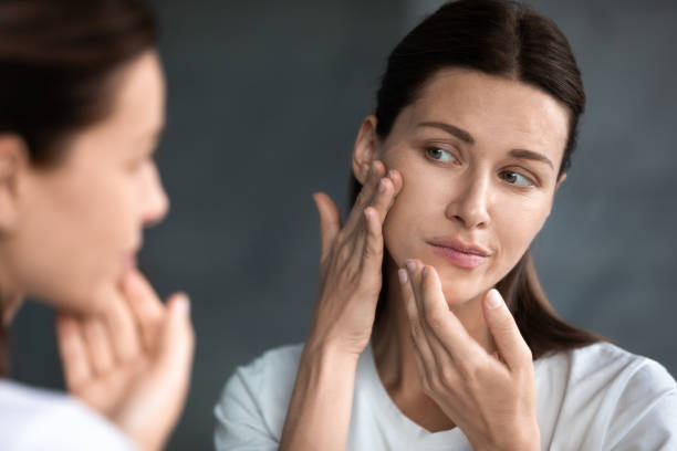 Improve Skin Texture
