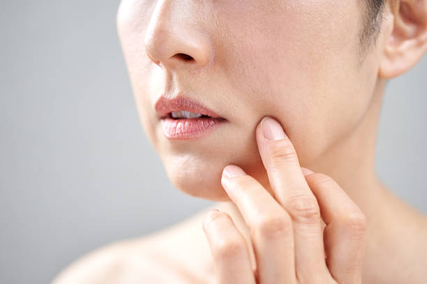How to Prevent Wrinkles