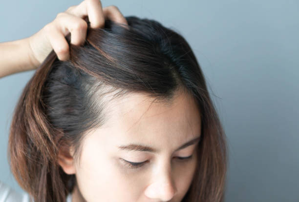 Get Thin Hair to Thick Hair