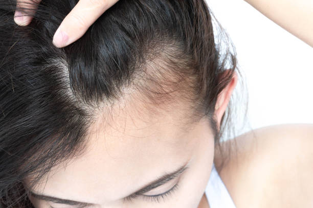 biotin regrow hair