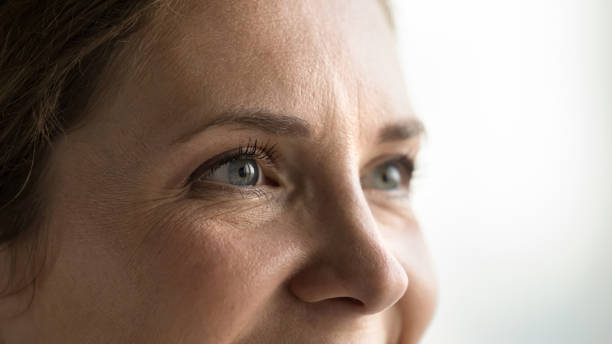 Get Rid of Fine Lines