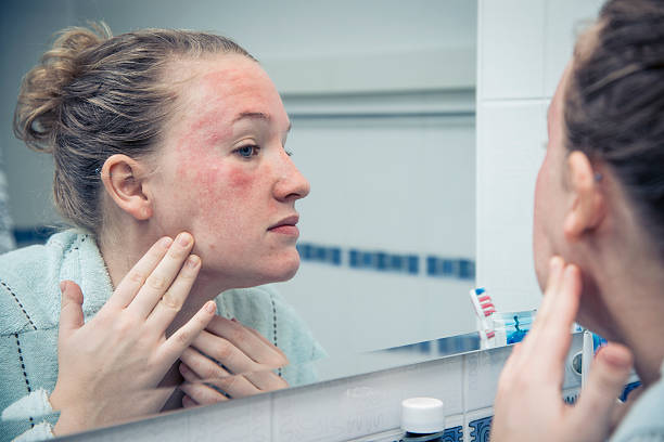 common skin problems