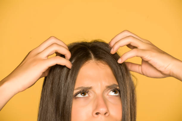 Itchy Scalp Treatment