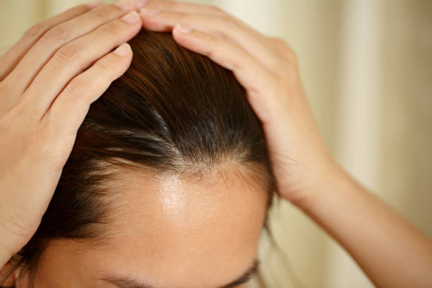 What is Scalp Pain