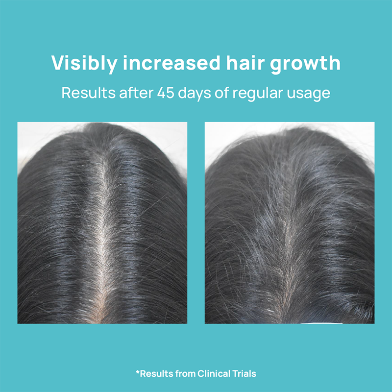 Buy HEALTHVIT BIOTIN HAIR GROWTH SHAMPOO  200ML Online  Get Upto 60 OFF  at PharmEasy