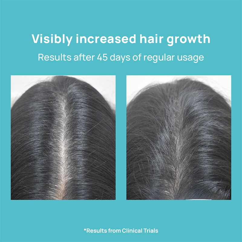 Biotin Hair Gummies